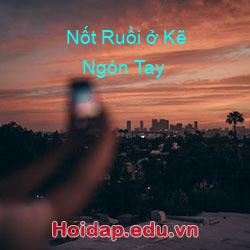 Nốt Ruồi ở Kẽ Ngón Tay
